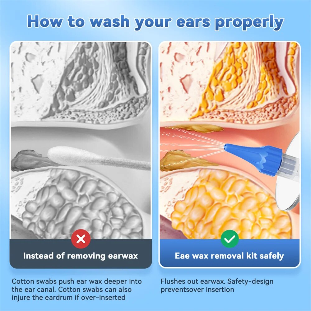 Ear Wax Removal Manual Ear Cle - Urban Farming System 评论和价格