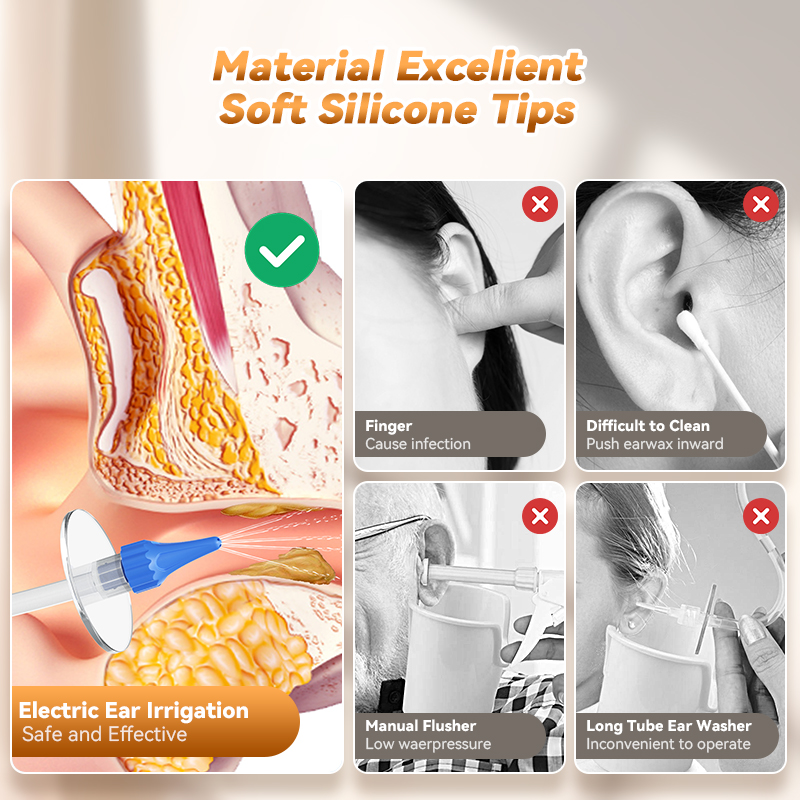 Ear Wax Removal Manual Ear Irr - Urban Farming System 评论和价格