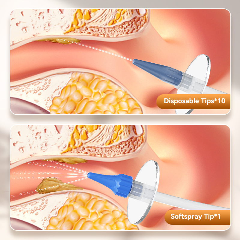 Ear Wax Removal Manual Ear Irr - Urban Farming System 评论和价格